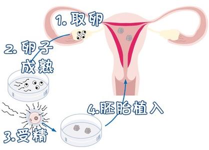 高龄二胎